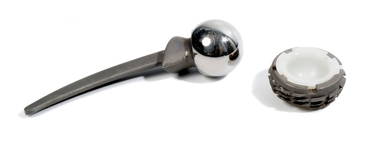 Defective Medical Implants and Product Liability – Some Important Facts