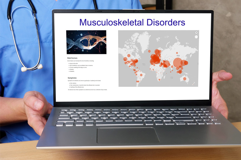 Musculoskeletal Disorders