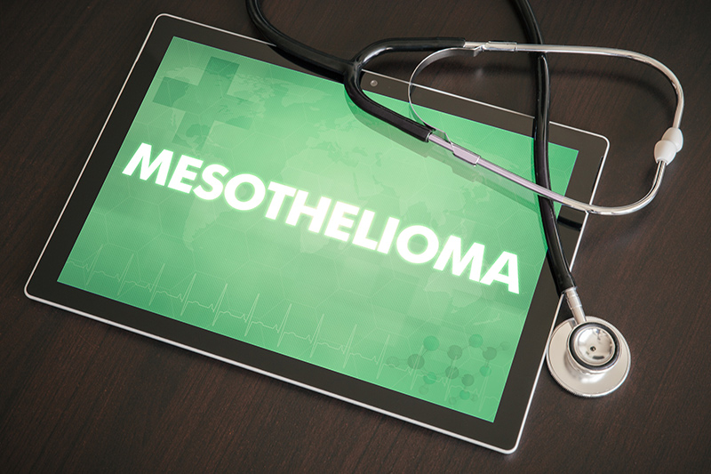 Medical Record Review Required For An Asbestos Exposure Mesothelioma Claim